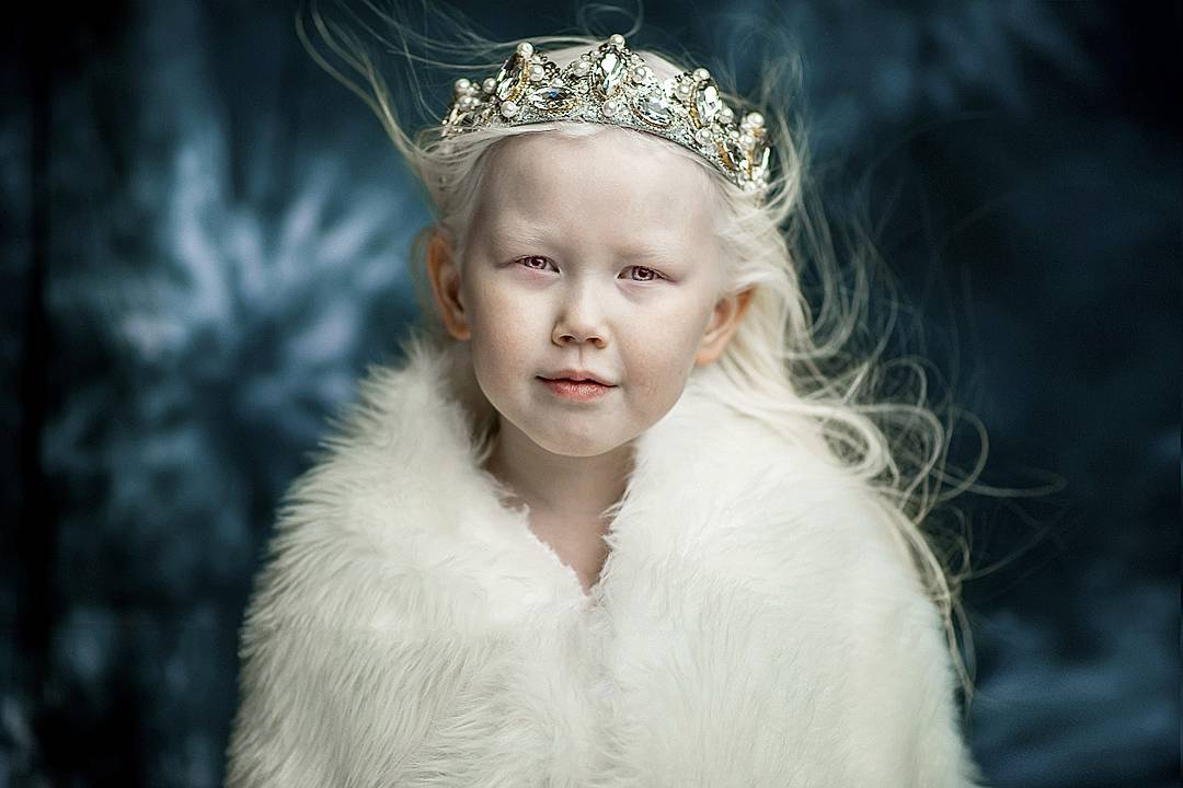 Белоснежка существует: девочка-альбинос покоряет модельные агентства мира