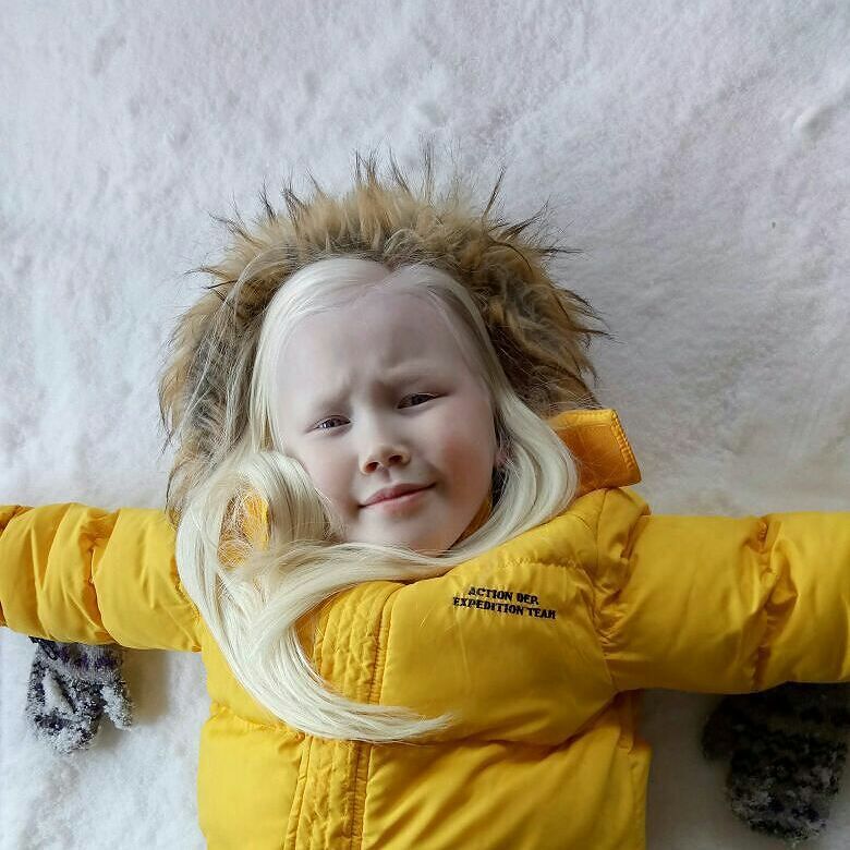 Белоснежка существует: девочка-альбинос покоряет модельные агентства мира